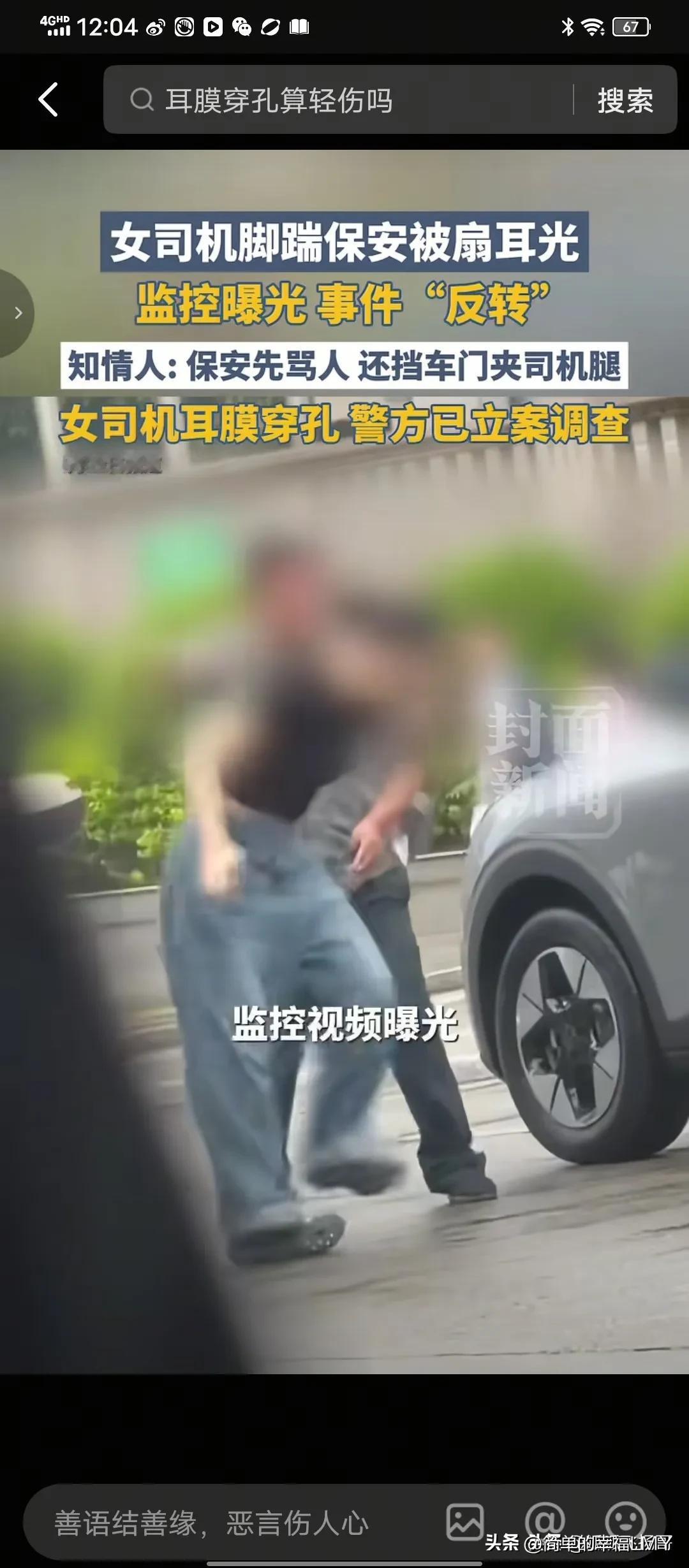 保安的大麻烦才刚刚开始！医院给出女司机的伤情结论，保安反手那一巴掌造成女子耳膜穿