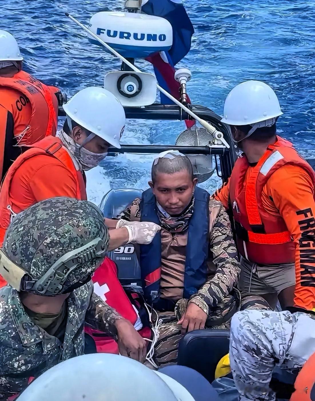 被“开瓢”的小菲猴又被接回了，接回时在我国海警的监督下进行，狼狈不堪。

希望这