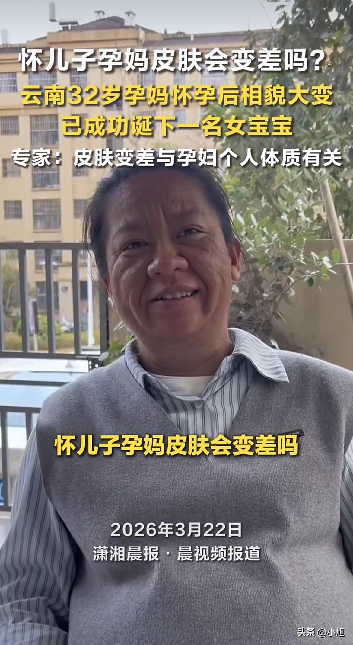 云南32岁的阿芹，怀孕后那张脸变化大到什么程度？满脸长痘，毛孔粗得能看见，肤色暗