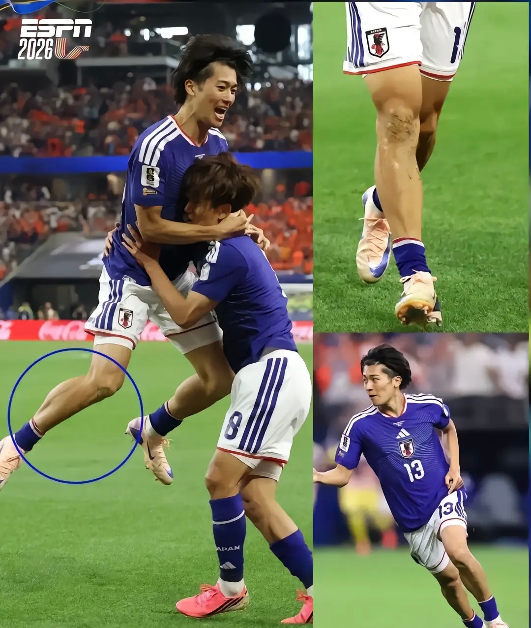 日本国脚中村敬斗的超小尺寸护腿板一个容易挨踢的前锋位，带这种起不到什么防护作用的