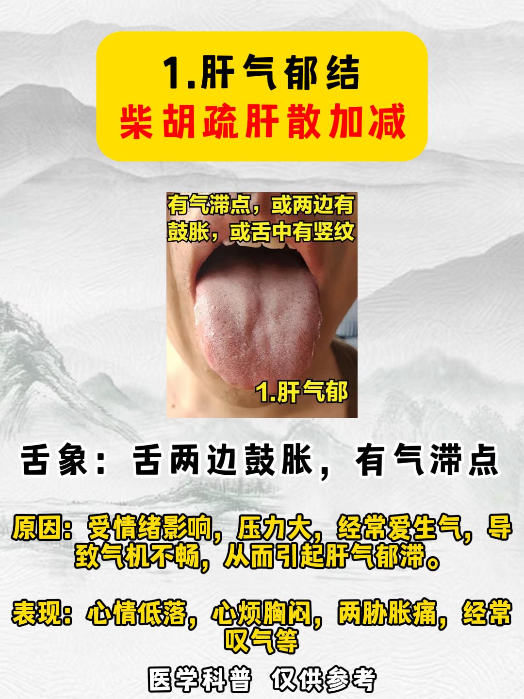 人有六郁：肝郁，食郁，湿郁，痰郁，火郁，血郁
你是哪种郁，一看舌头便知！
#科普