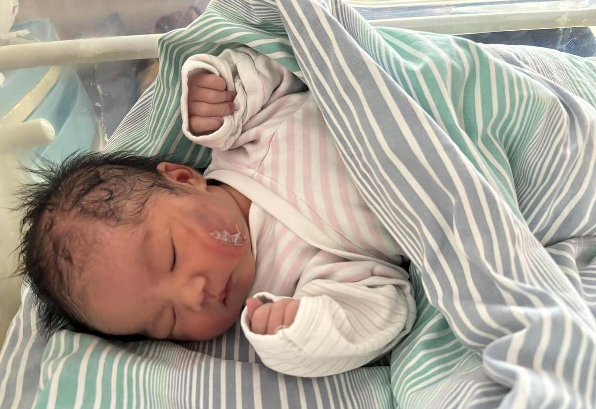 疤痕不是丑，是生过娃的勋章。
硅酮胶天天贴，比啥美容仪都管用。
剖不剖，别听网上