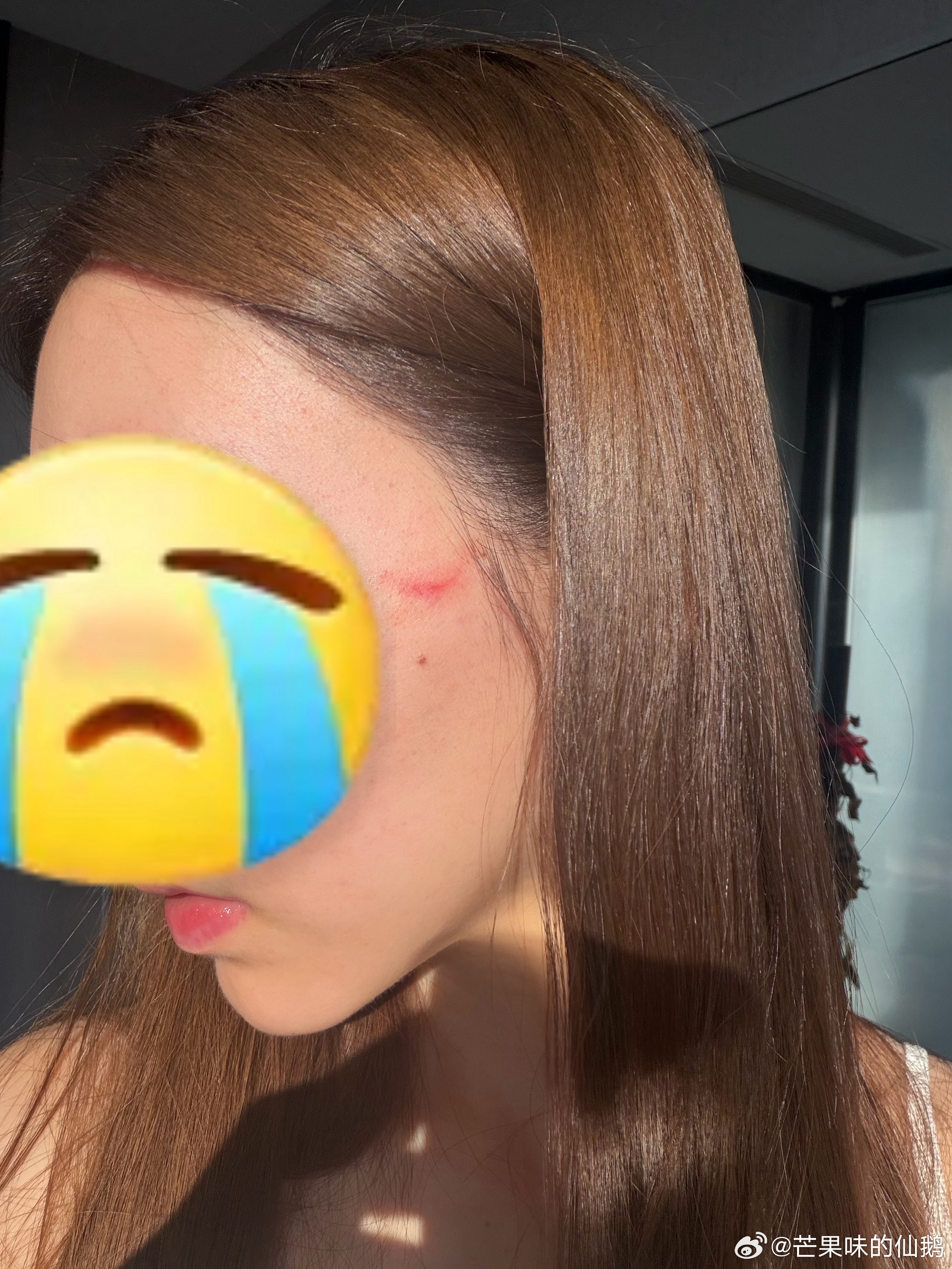 刚刚照镜子才发现…..睡着之后被灰灰抓了脸…..现在我的心碎了…….好难过…….