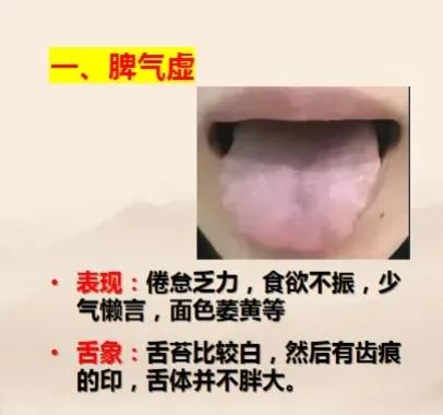 脾胃虚弱的14个阶段，你知道自己处于哪个阶段吗？今天周老师带你自测一下！

周老