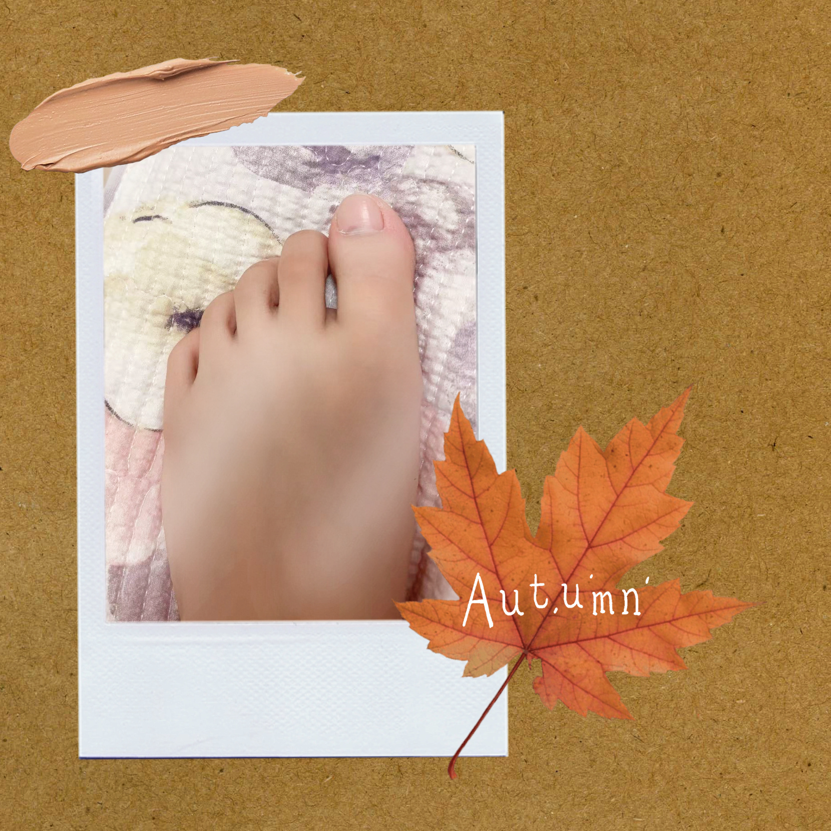 这个中秋过的一言难尽左脚大脚趾被砸淤青右膝盖骨半月板损伤 双重的疼痛😩[苦涩]