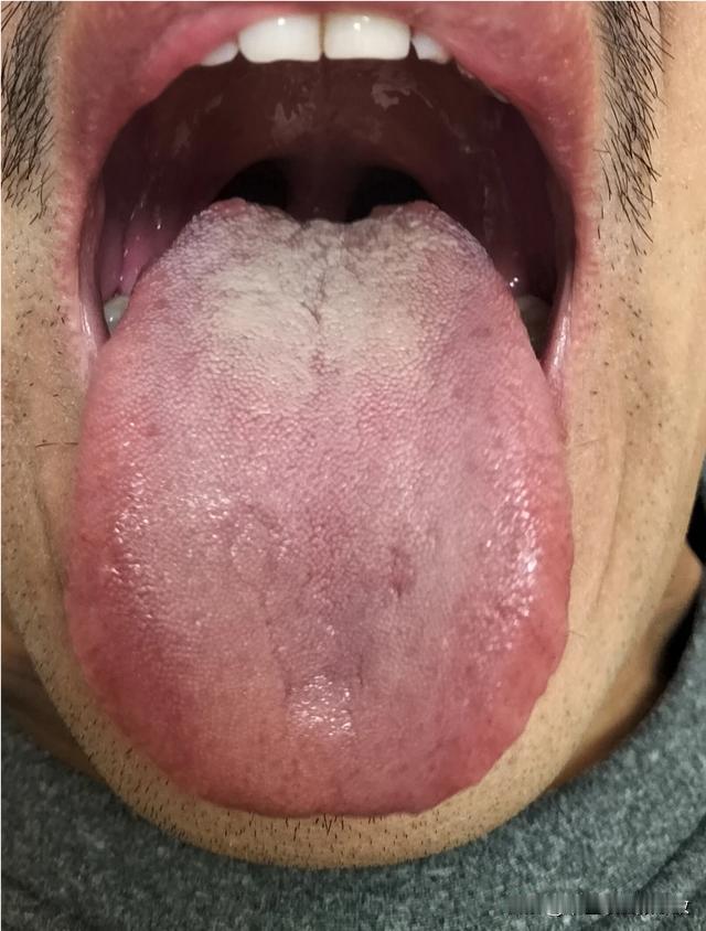 人菜瘾大[抠鼻][抠鼻][抠鼻]说的就是这样的舌头[狗头][狗头][狗头]
粉丝