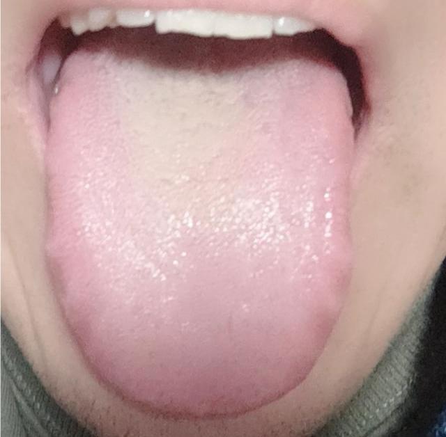 小兄弟虚不受补就算了，还仗着年轻瞎吃药，怪不得你上火！

先来说说小伙的具体问题