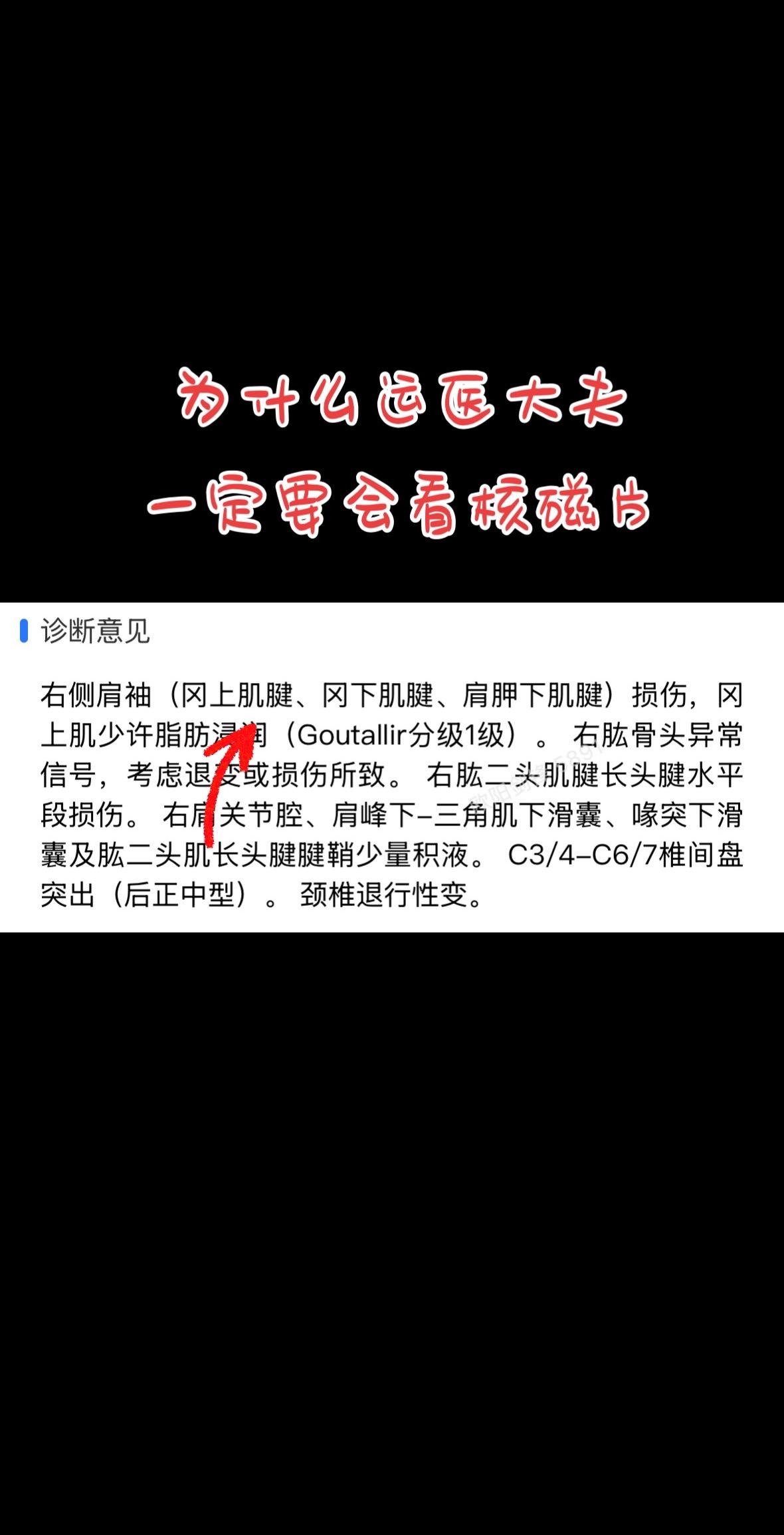 为什么问诊需要提供核磁片。为什么报告只能参考，来门诊或问诊的朋友完善核磁片先