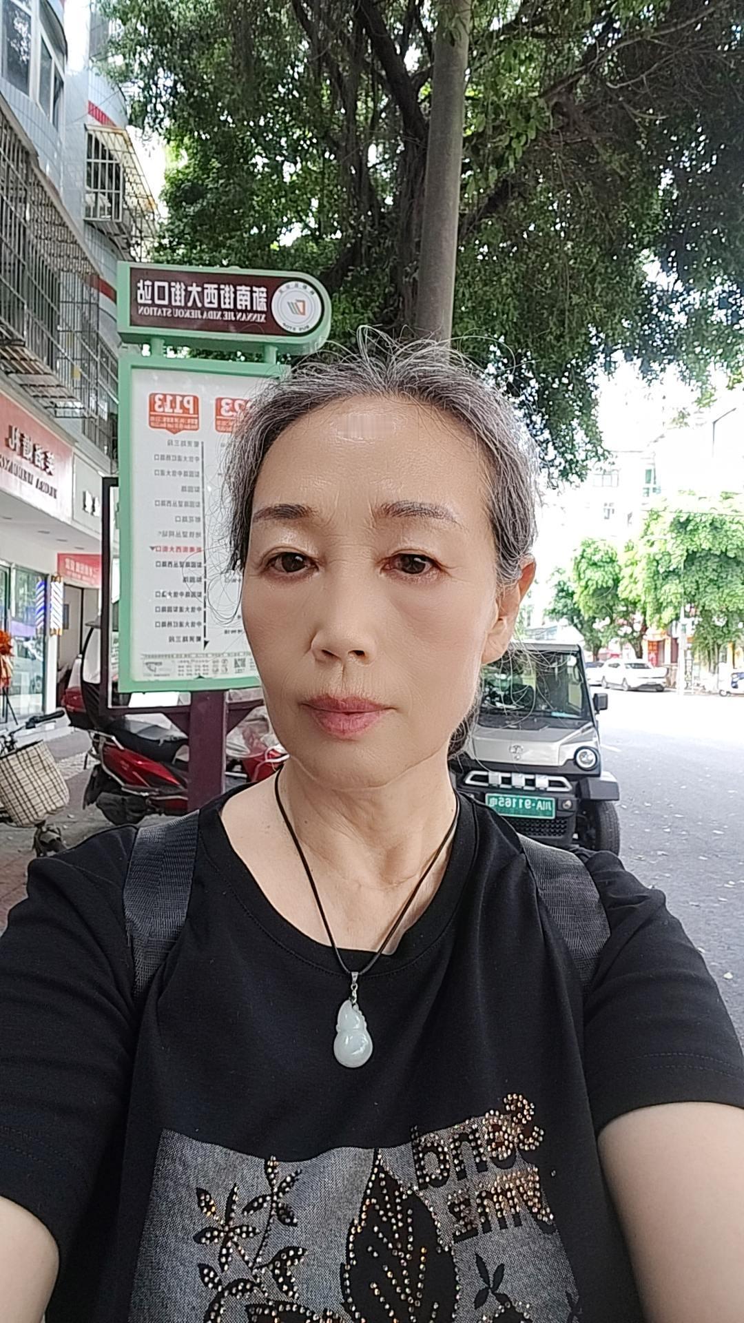 今天去贴三伏贴，在等公交车的时候，用原相机拍了一张照片下63岁的我，皱纹斑点眼袋