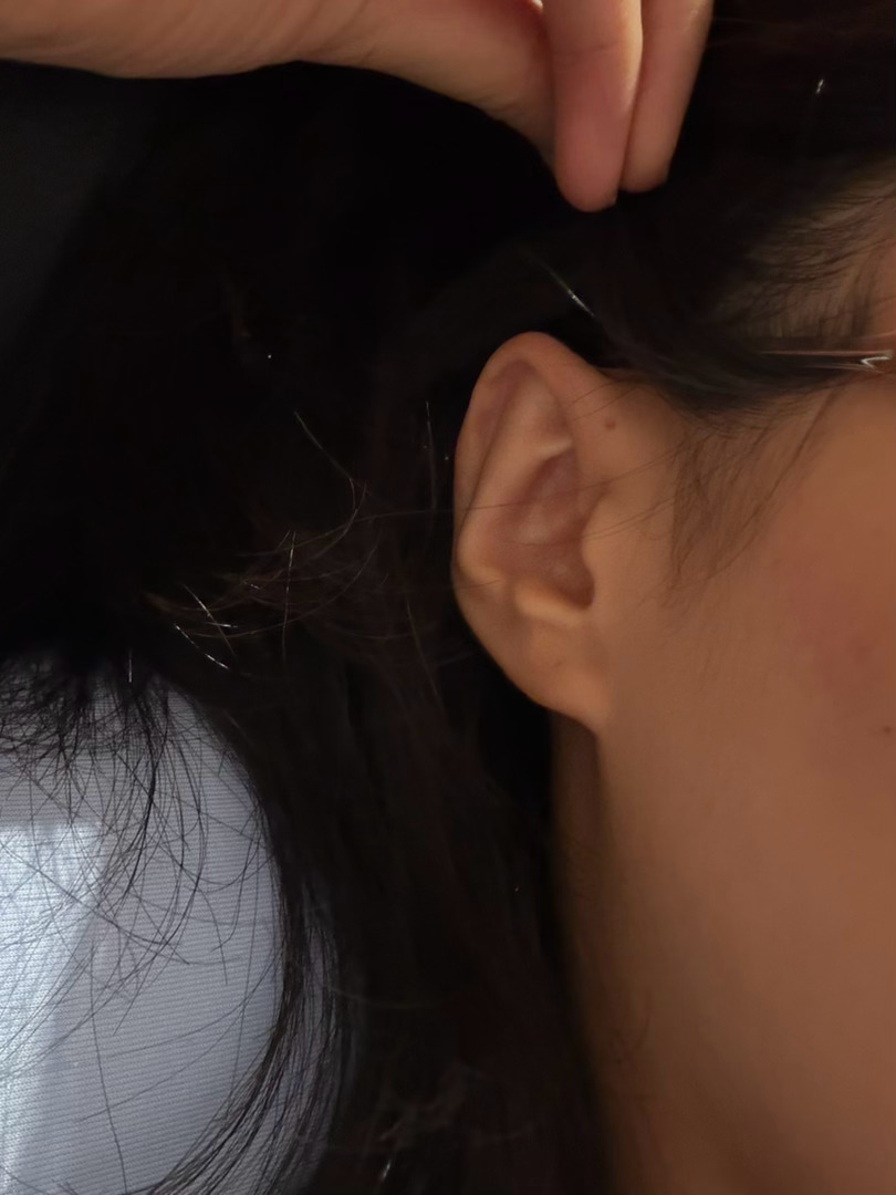 妈呀 你们记不记得我那个脚底痣视频说我全身只有耳朵是好的我才发现我耳朵这个洞叫耳