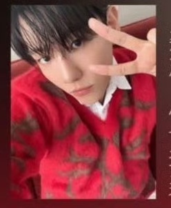 边伯贤鼻子怎么了 ​​​