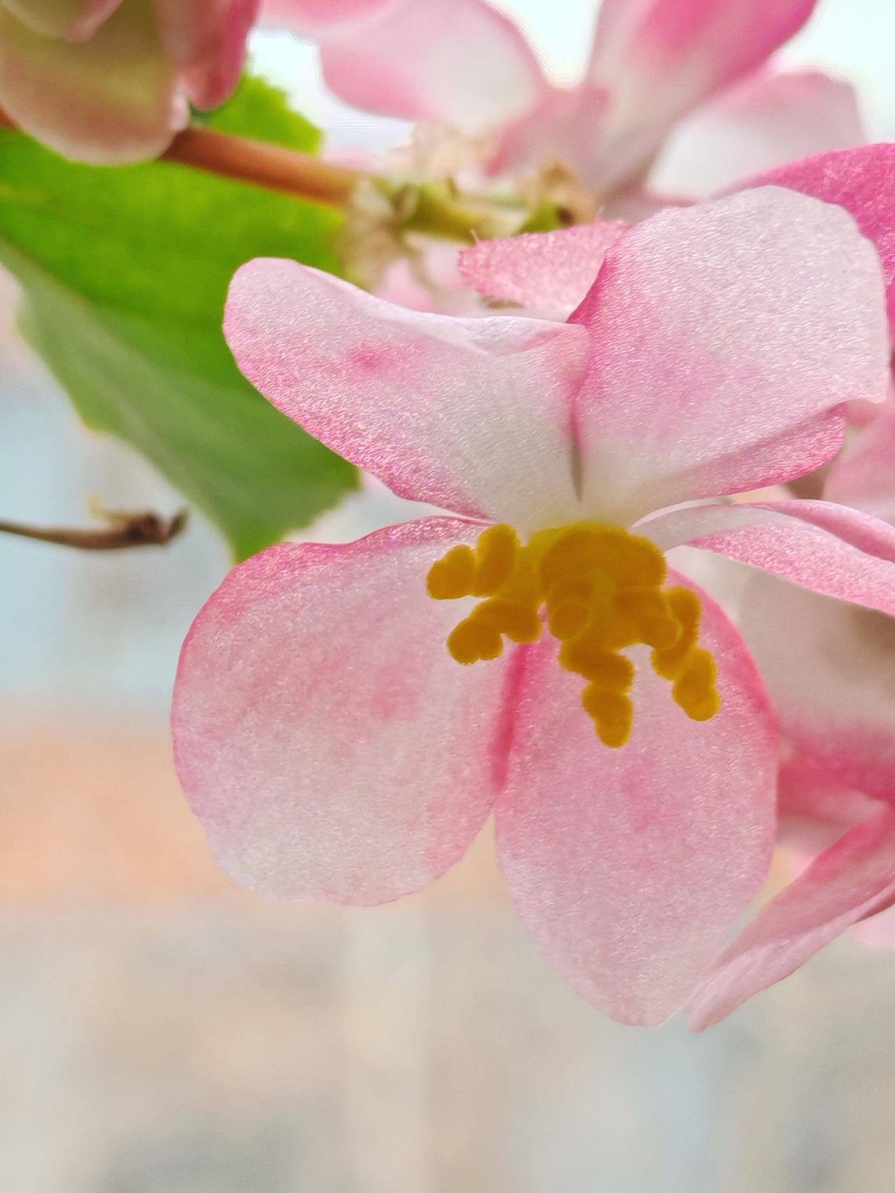 与痛风斗争的历程224
 
   清晨醒来，周身关节状态平稳无不适，唯独左肩关节