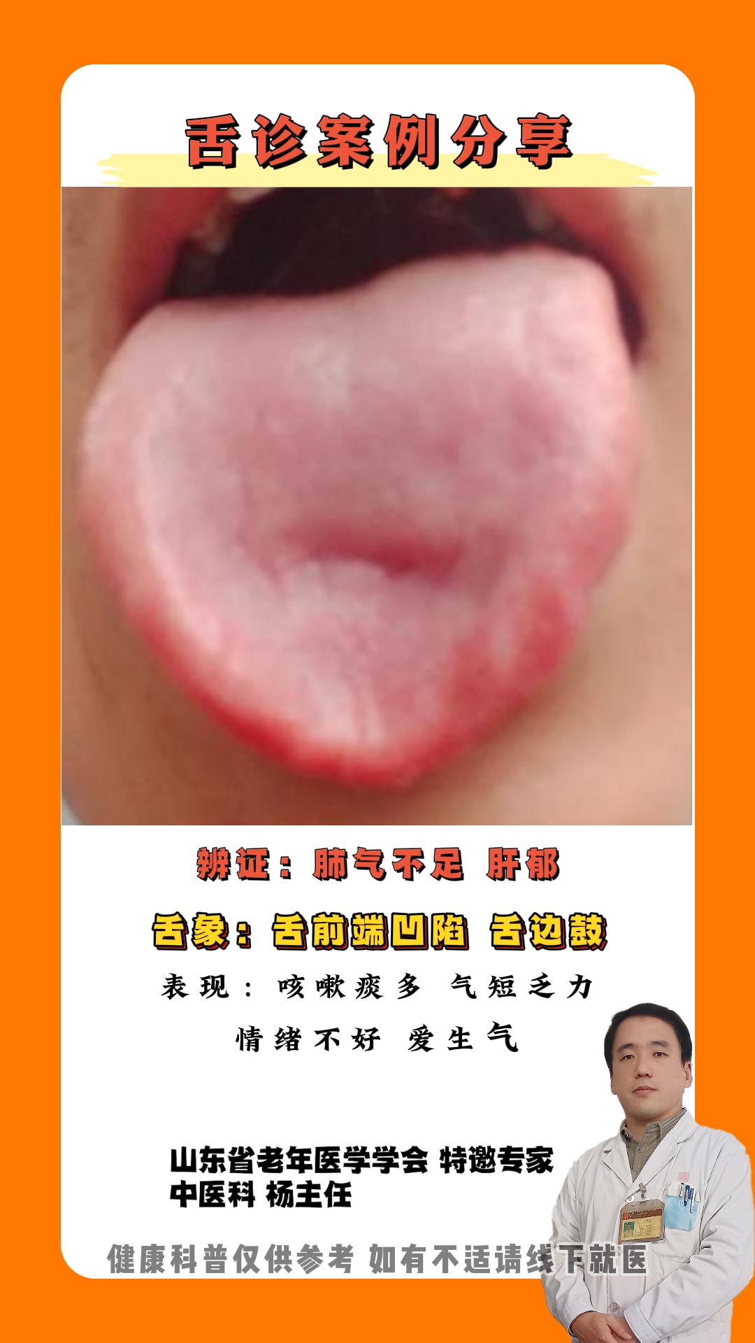 健康科普 舌象 中医科普 涨知识