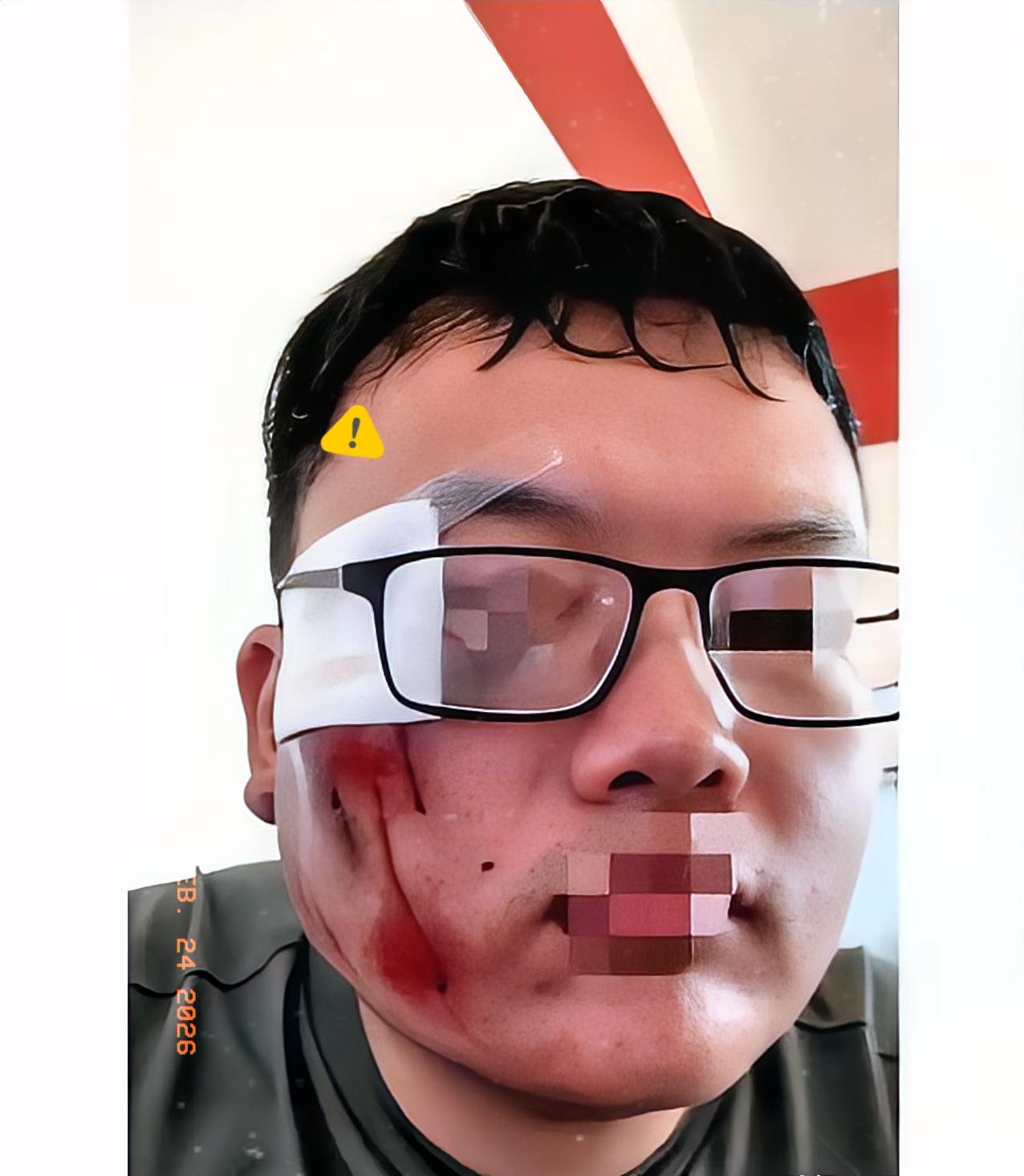 他拒绝了1000块封口费，坚持罚了对方2000，几天后，他躺在地上才懂：自己罚人