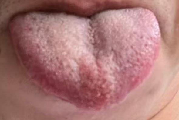气血不畅、固摄不足？中医方法帮你理顺周身状态






为什么关键时刻海绵体可