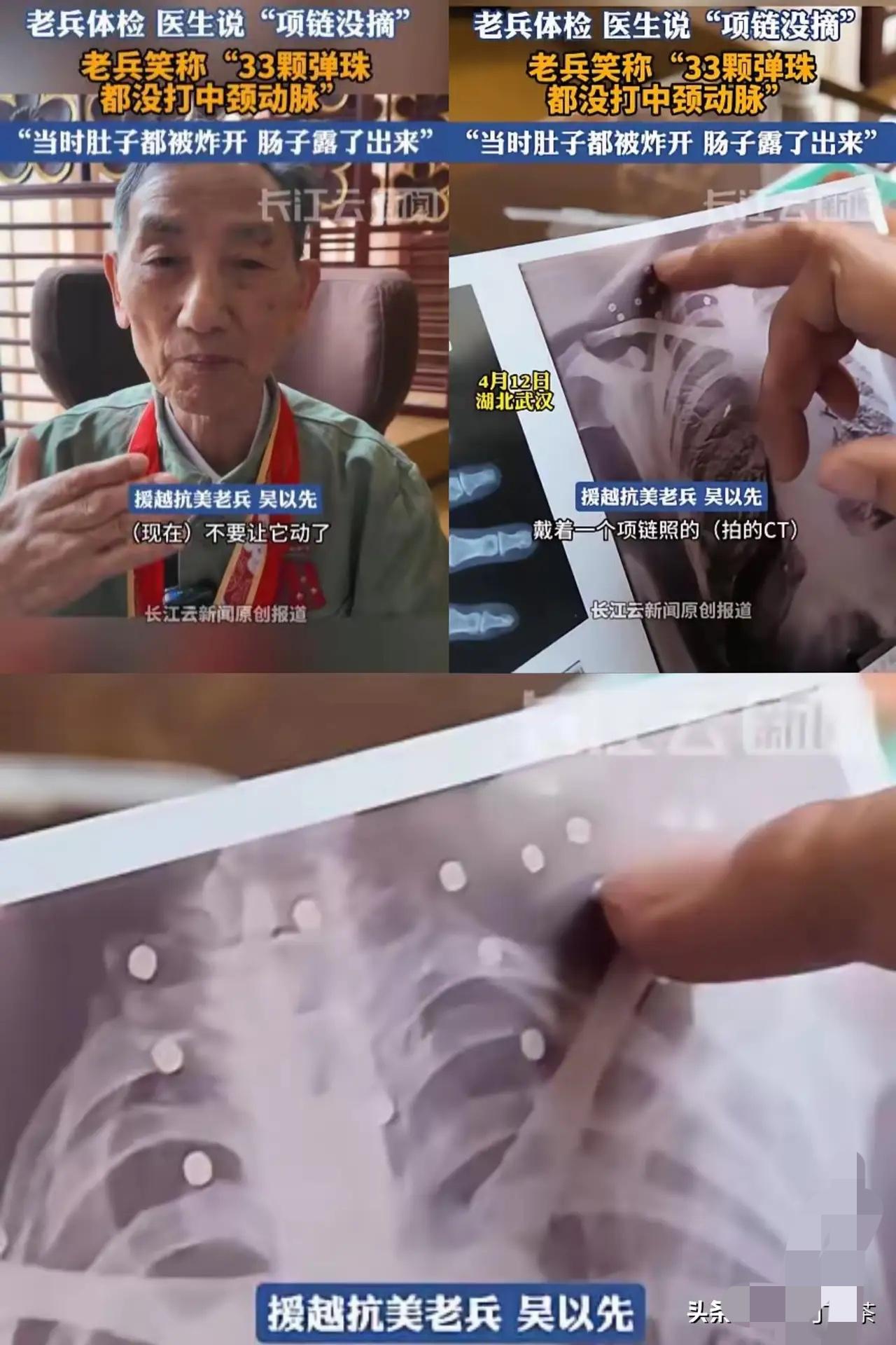 “这就是命啊！”4月12日，湖北武汉，一老人到医院里检查身体，拍CT的时候医生看