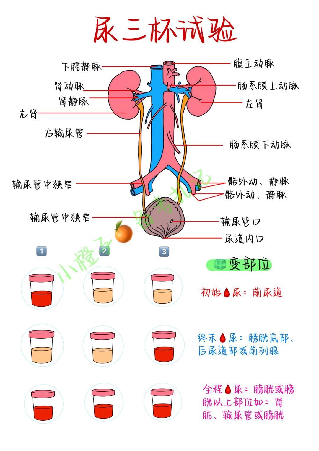 📖尿三杯试验｜你学会了吗❓