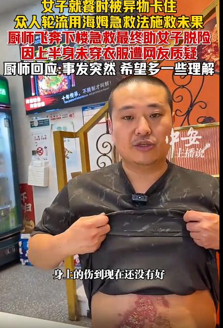 男店员回应赤裸上身急救卡喉女子，男店员肚子上被油给烫伤了，没有穿上衣，因为事出紧