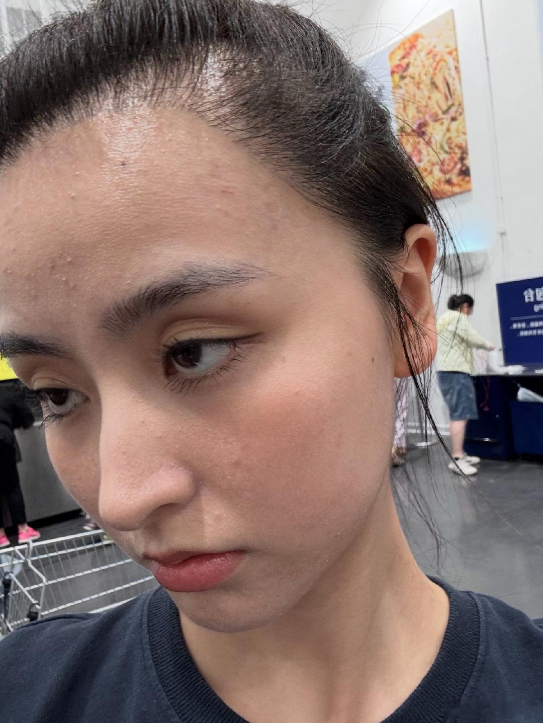 金子涵晒近照 金子涵晒近照，好真实的皮肤状态金子涵说从发现白癜风已经三年了
