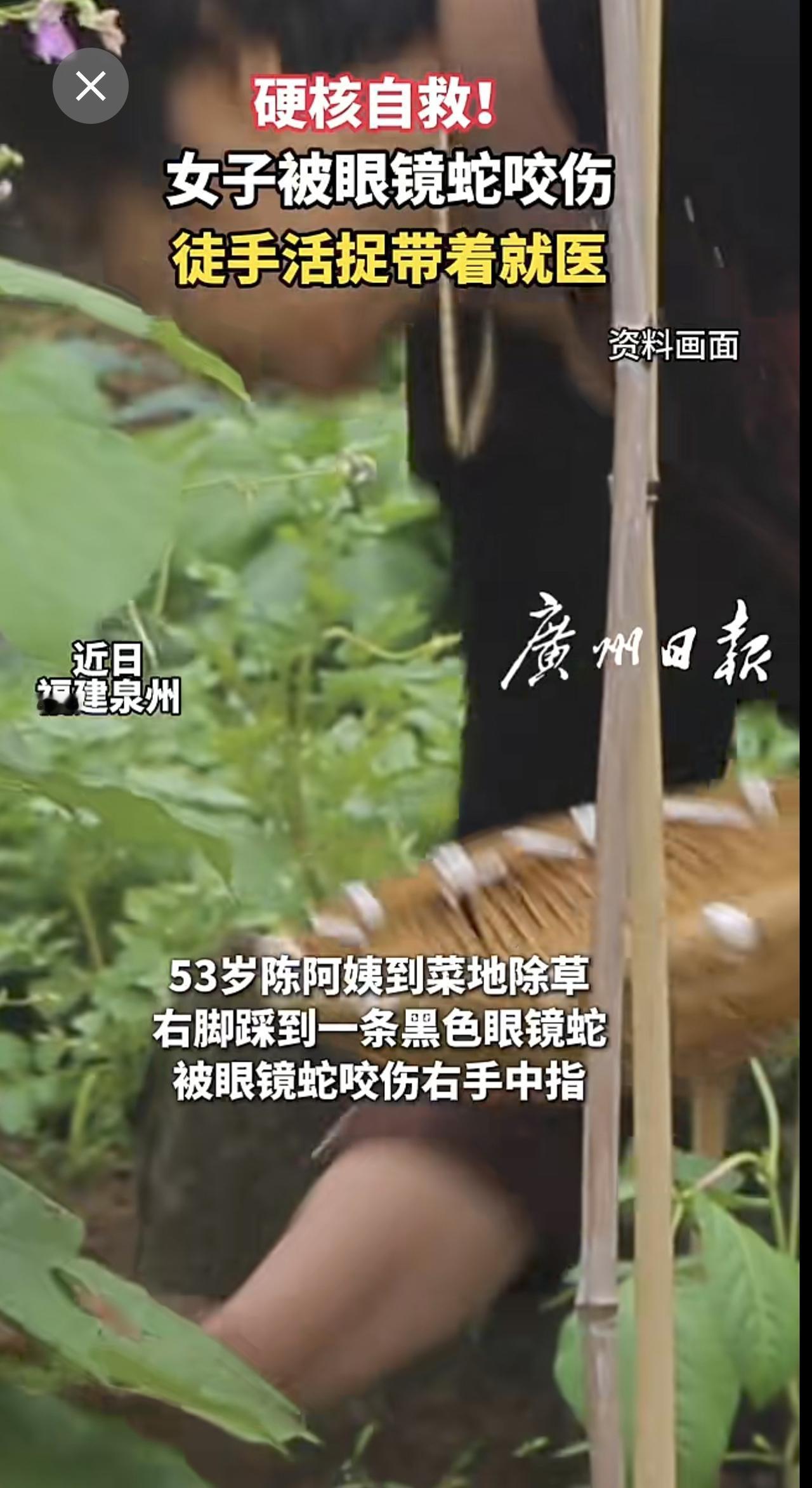 硬核自救！女子被眼镜蛇咬伤，徒手活捉带着就医眼镜蛇