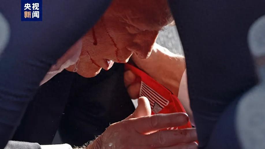 #特朗普称右耳被子弹击穿# 美国前总统特朗普最新发表声明，称自己的“右耳上部被一