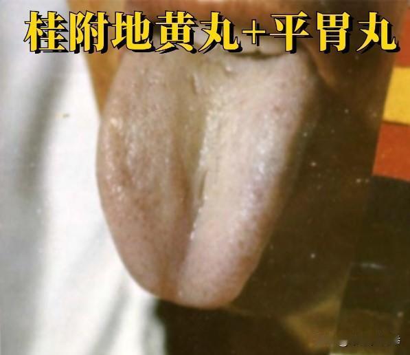 千寒易去，一湿难除，桂附地黄丸搭的好，可以扫清体内90%的湿气
桂附地黄丸+平胃