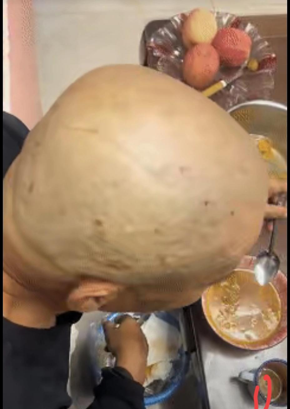 天津大爷剃头剃出满头血痂，女儿气着要找理发师算账，他却淡定干饭拦着不让，这事儿又