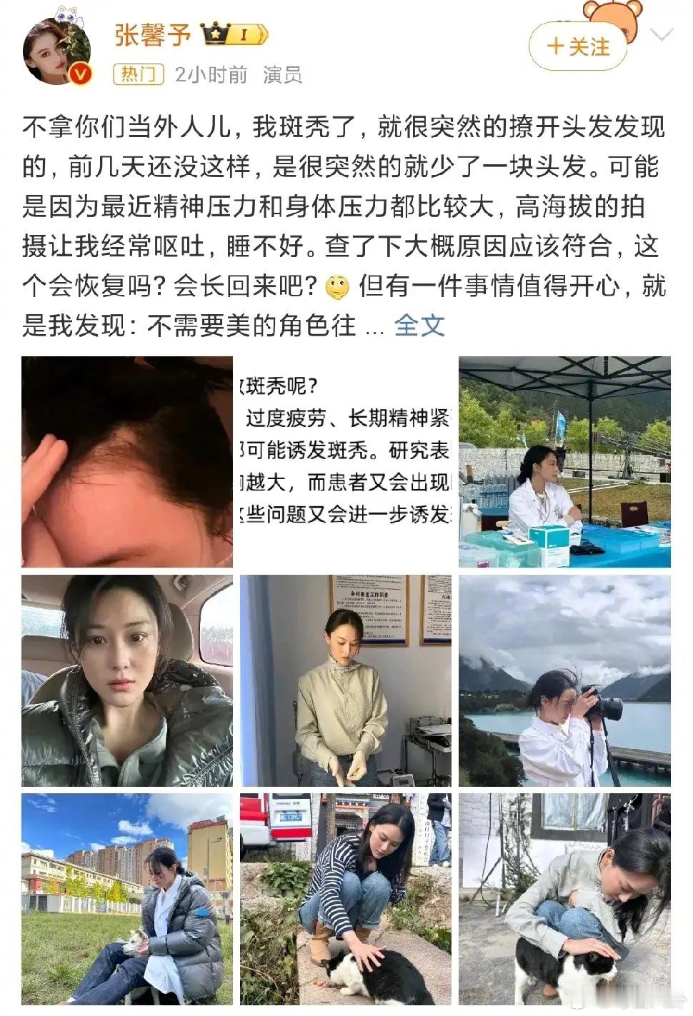 #张馨予 斑秃# 张馨予透露自己因压力太大斑秃了，还晒出了自己满脸晒斑的照片，从