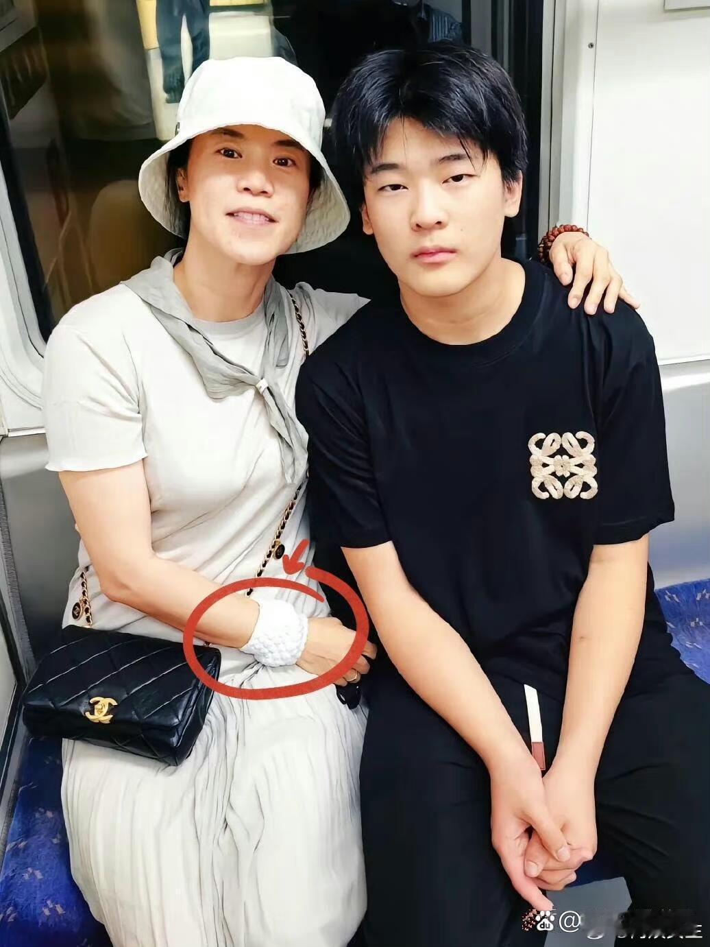 王楠和儿子坐地铁，戴着几千万的手镯，为了防止地铁人多被碰碎只能包起来保护。 ​​