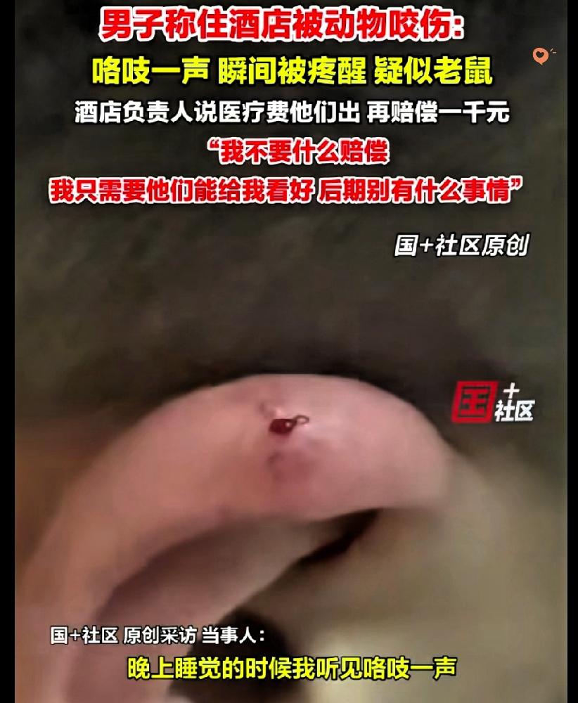上海男子出差住酒店，半夜被不明物体咬得耳朵流血，医院诊断疑似鼠咬伤，可酒店的操作
