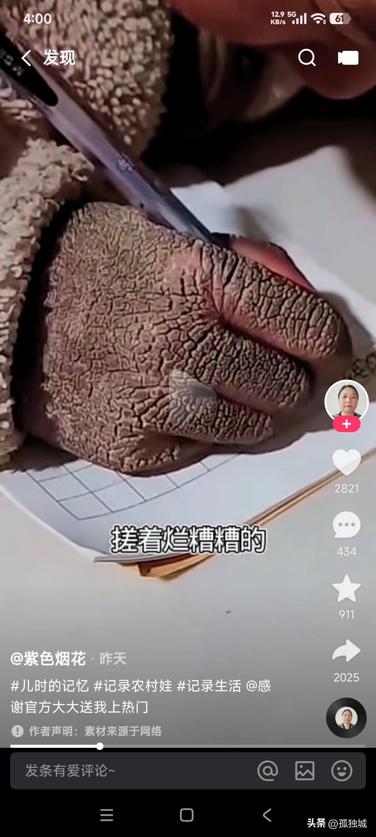 我绝对不相信一个小孩子的手会像树皮一样，这肯定是一种什么病，小孩子的手在脏在裂绝