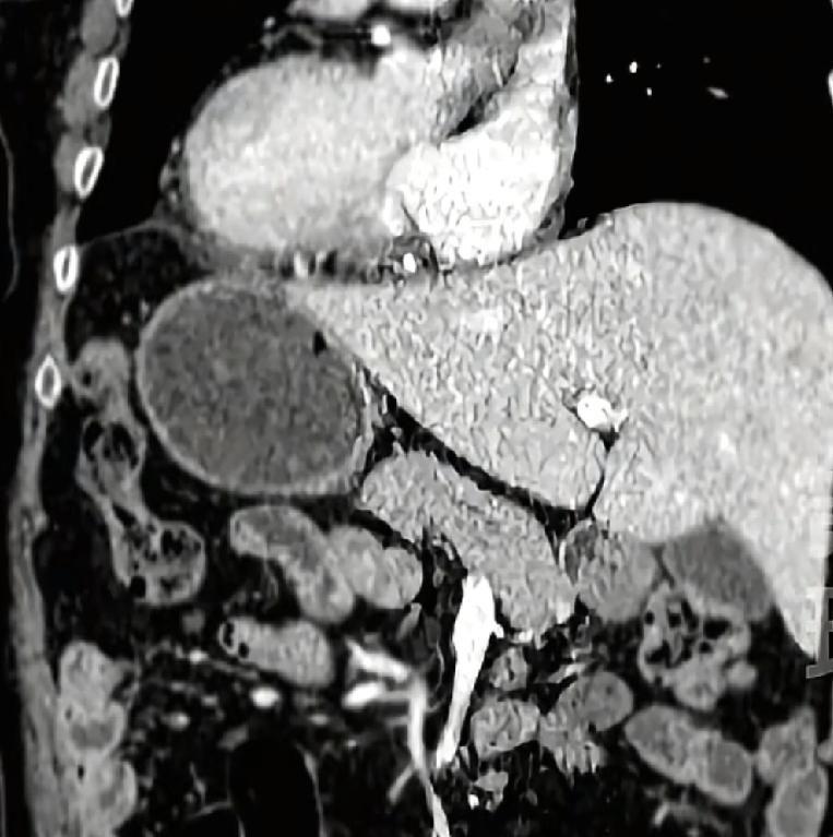 难道世界上真的有这样的人？
不见一位男子，自己感觉身体不舒服，于是就去做了检查，