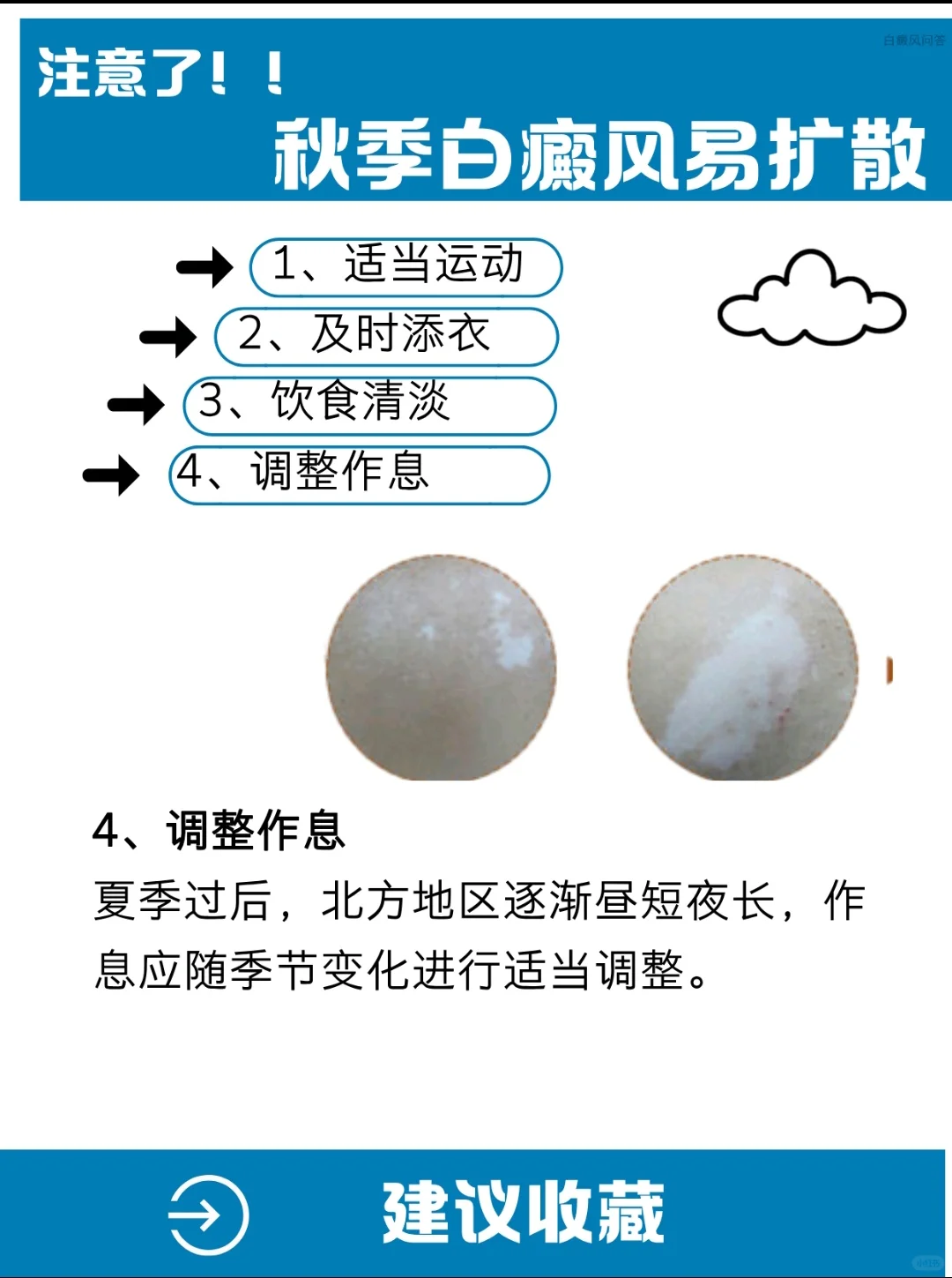 秋季白癜风易扩散？这些日常习惯注意🔔