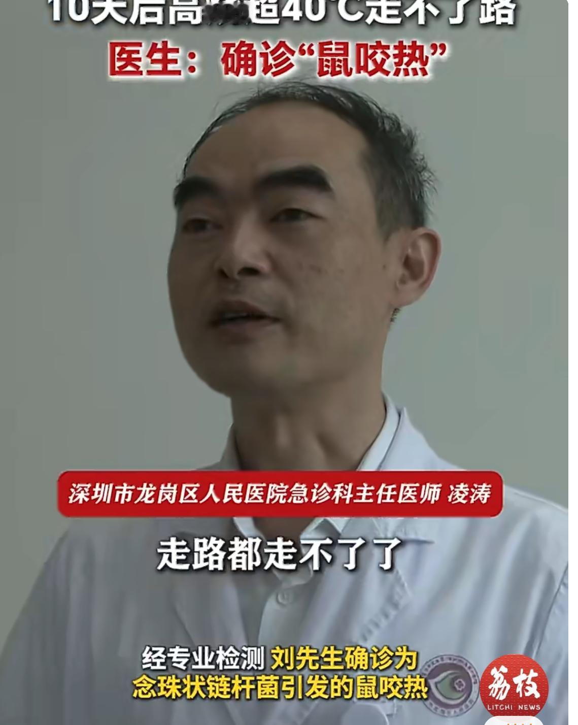 警惕！被老鼠咬10天高烧40℃，确诊鼠咬热
 
近日，广东深圳发生一起惊险案例。