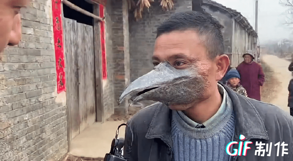 这是真的？
还是故意伪装？
只见路人聊了几句，拔腿就跑！

由此可见，这形态真实