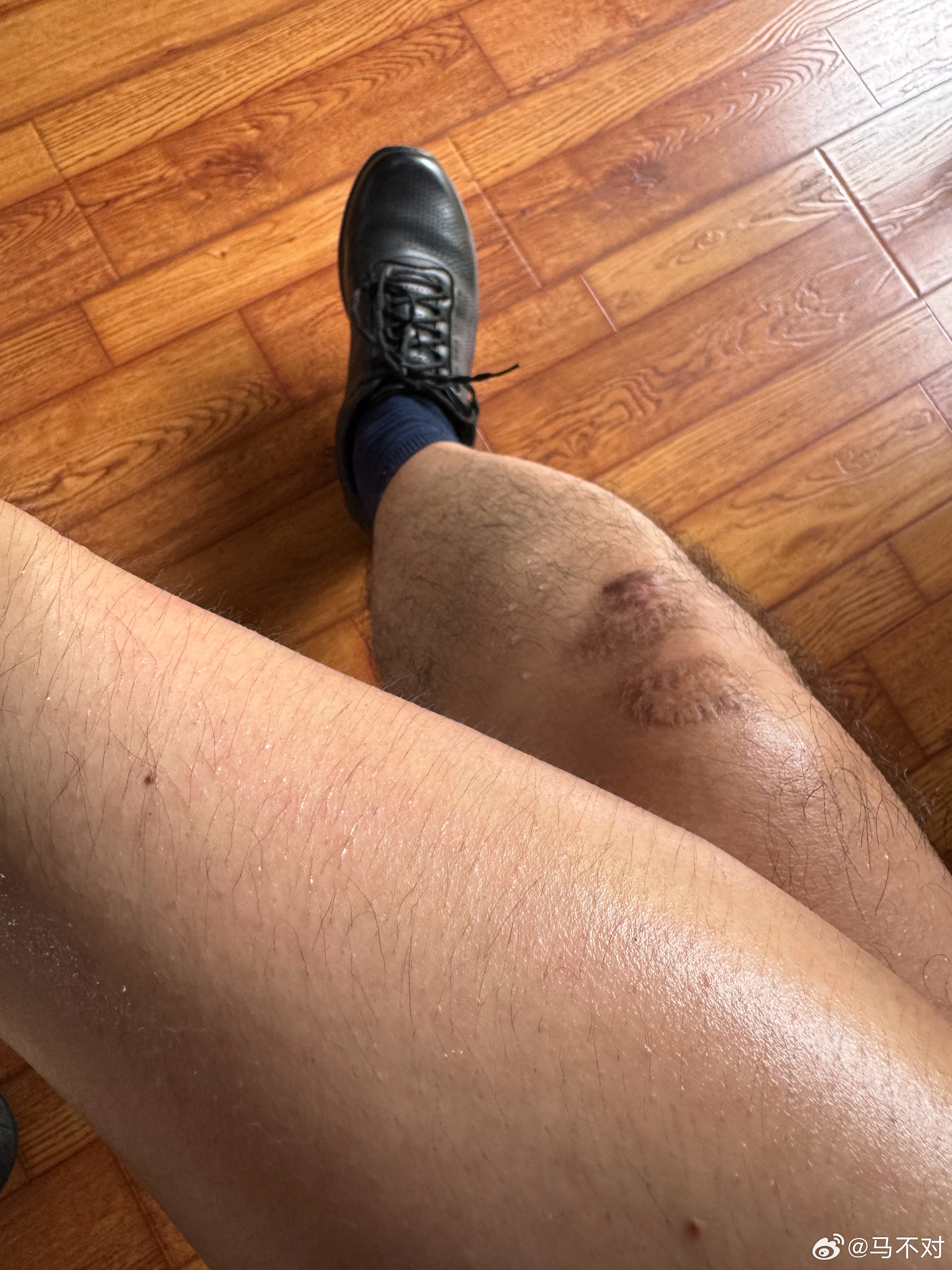 又搬了三趟还剩一半没搬完累的车上地上身上到处都是水 合肥·翡翠湖风景区
