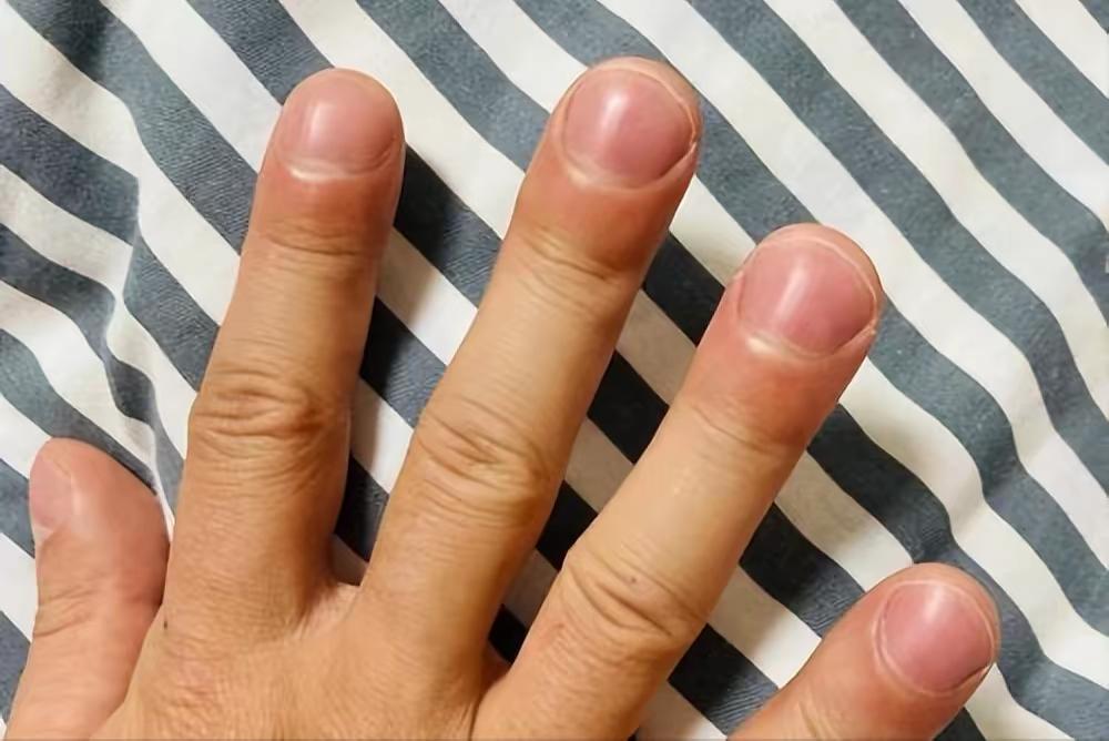 以手相谈健康，这种健康吗？[吃瓜群众]