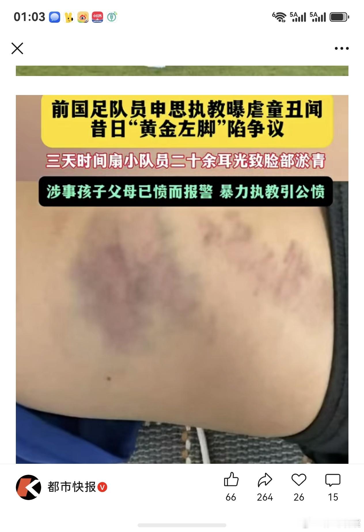 申思不是假球被终身禁止从事足球了吗？怎么还能带小孩训练踢球？结果又打小孩了。。 