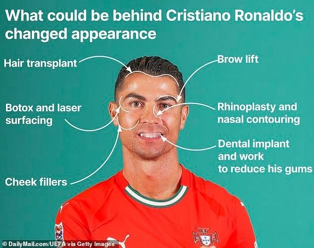 很正常，球星也是星，为了保证自己的商业价值做做医美整容啥的挺能理解的 