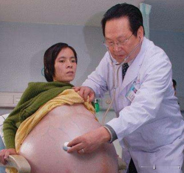 2007年，怀胎12个月的女人，在丈夫的陪同下，挺着巨肚，来到了广州医院检查，没