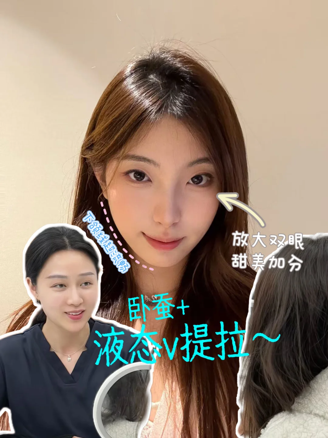 胡院约到了！年前轻松get网感幼态脸