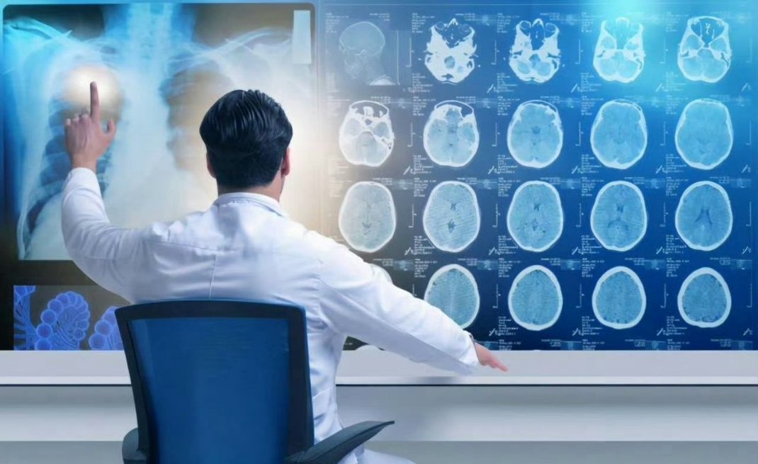 当村医用上AI会发生什么有人觉得能帮基层大夫减负，缓解乡村看病难的困境。也有人心