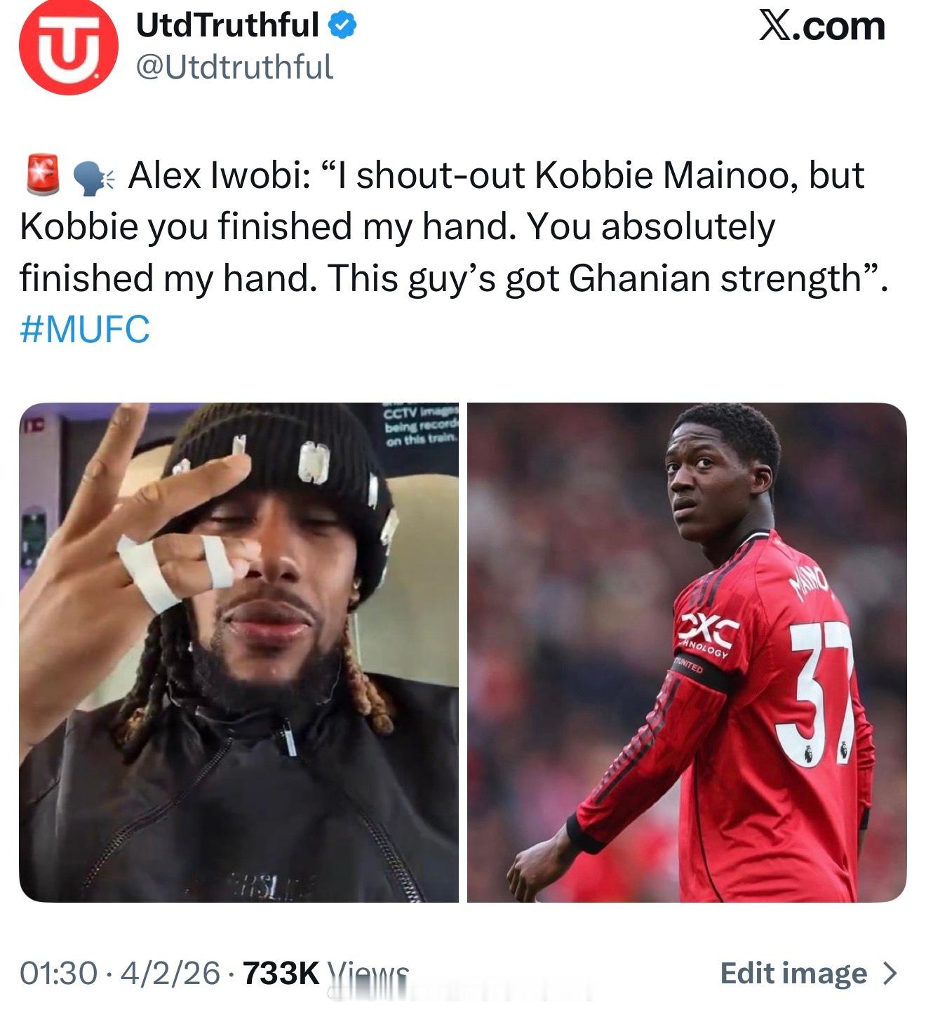 伊沃比：我是冲梅努嚷了，但梅努把我手指搞骨折了，真吧你手搞废了这是啥时候发生的？