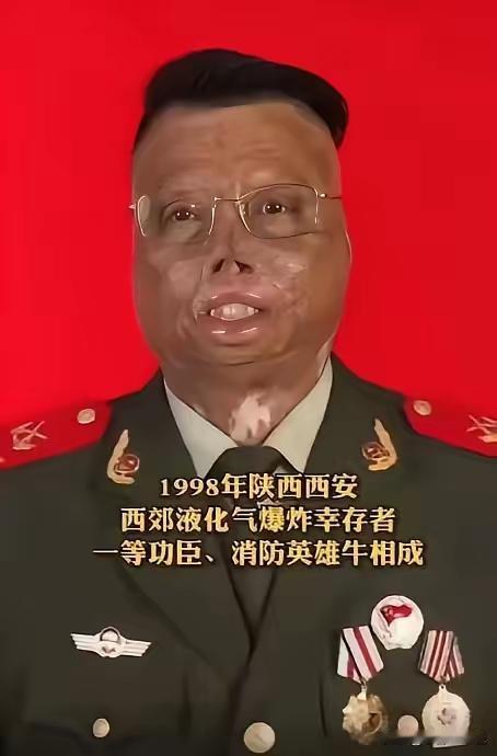 双向奔赴的感动！21岁火海致残的英雄，26年后被当年的孩子温柔治愈
 
真的破防