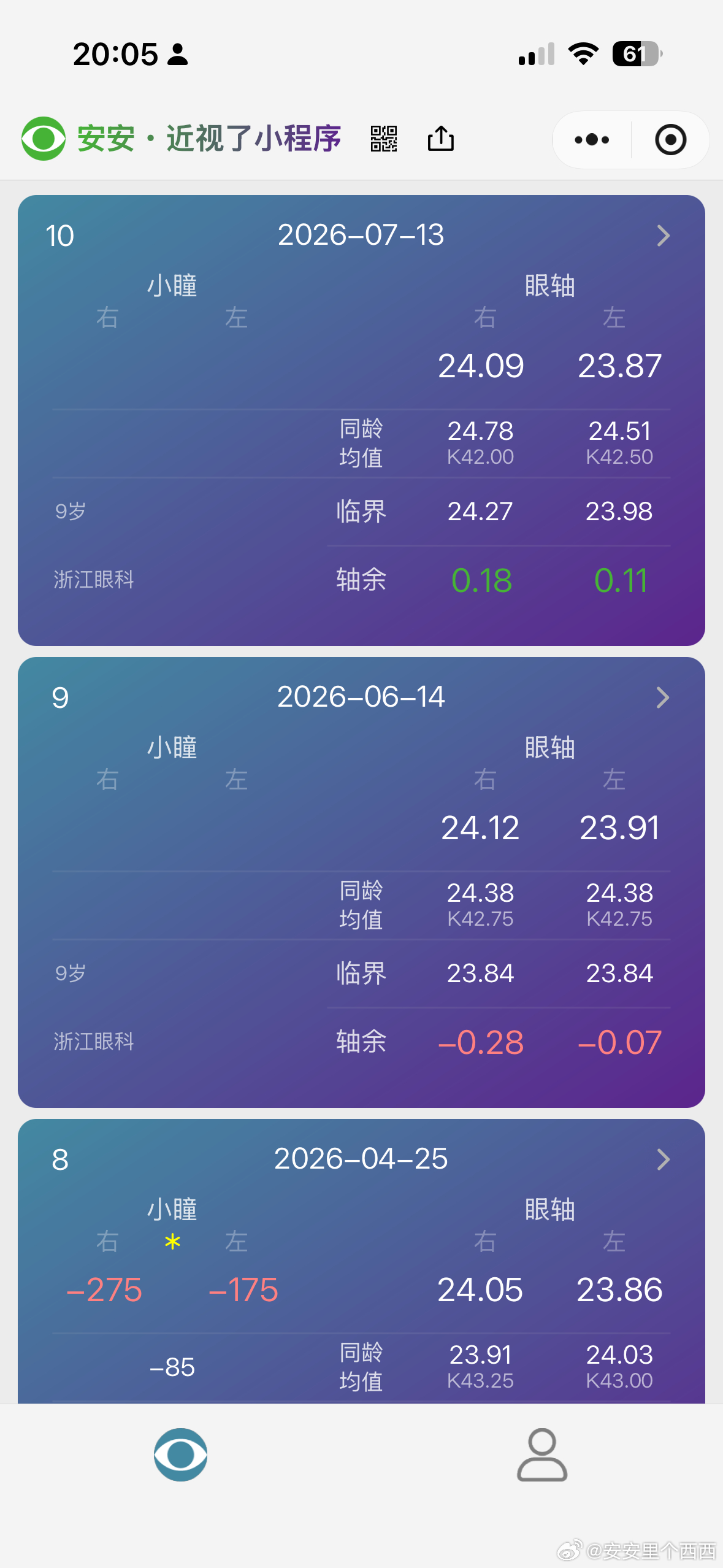 今天带安安去复查眼睛了OK镜适配度还可以在停用阿托品的情况下眼轴也退了点目前来看