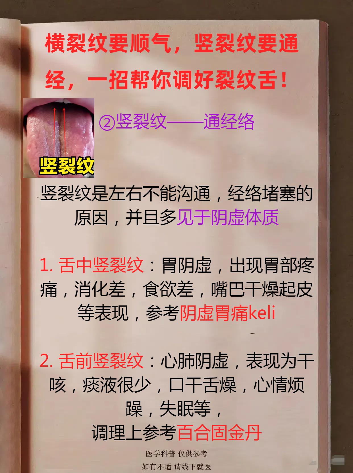 想调好裂纹舌，记住这句话不会错：竖裂纹就通经，横裂纹就顺气！