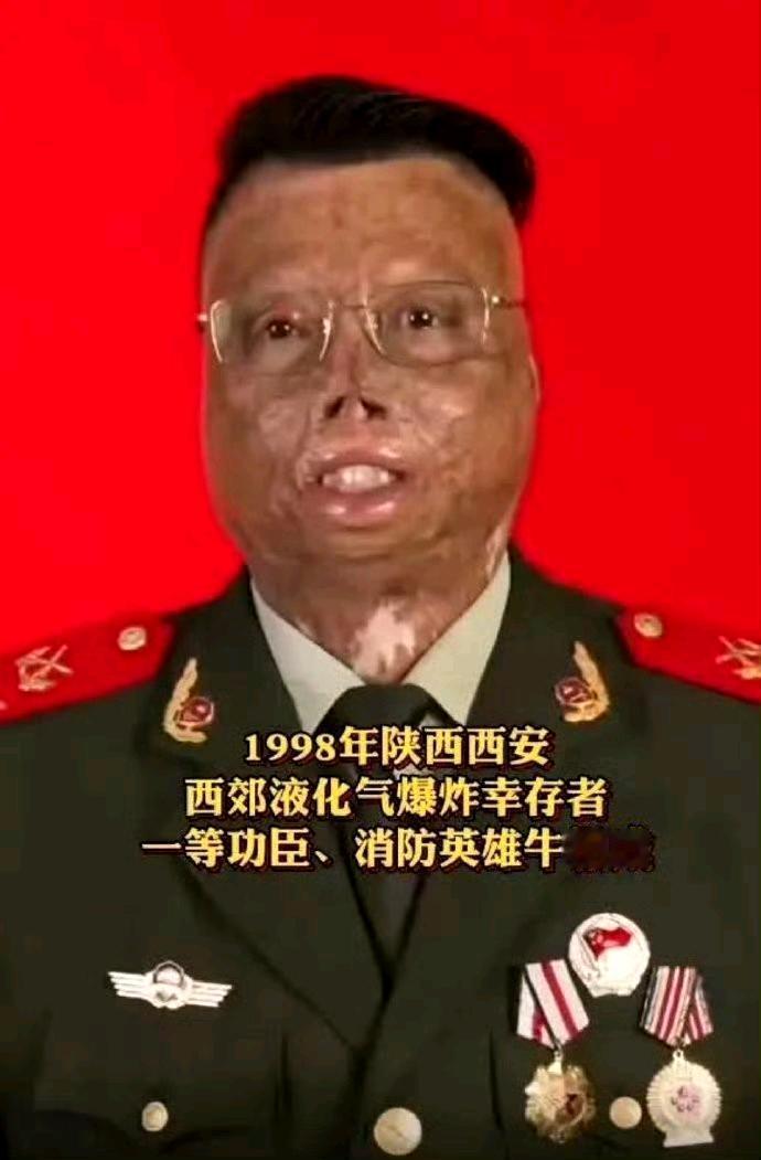 致敬消防英雄牛相成!舍身救人烧伤面积达97%，立一等功！ ​​​