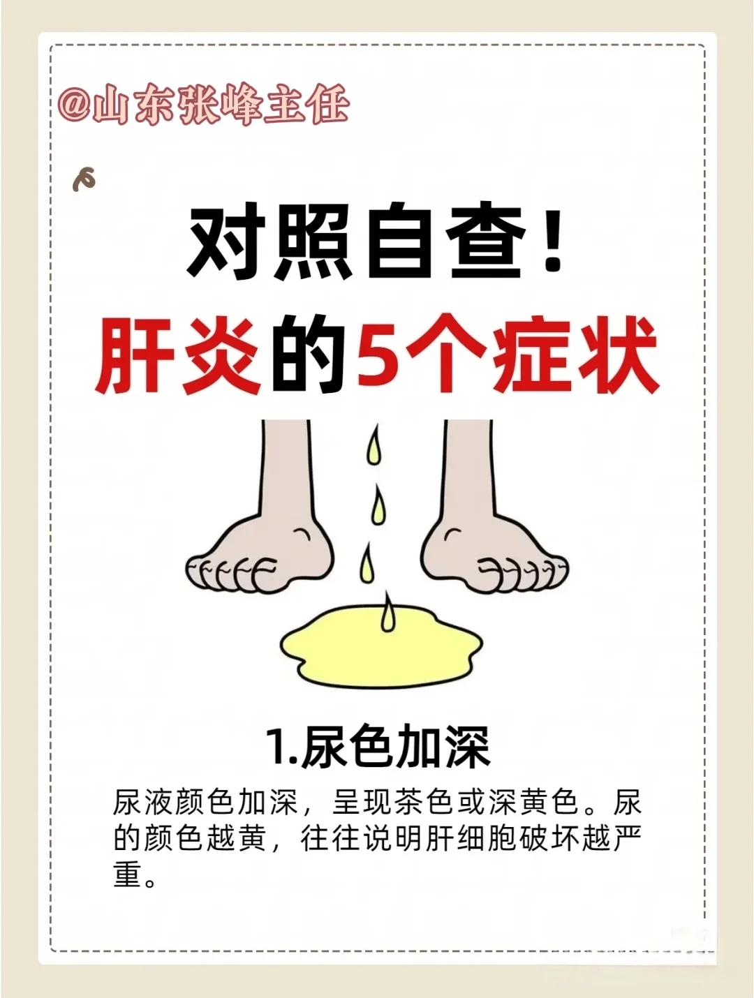 身体出现 5 个变化？警惕肝炎在 “敲门”！