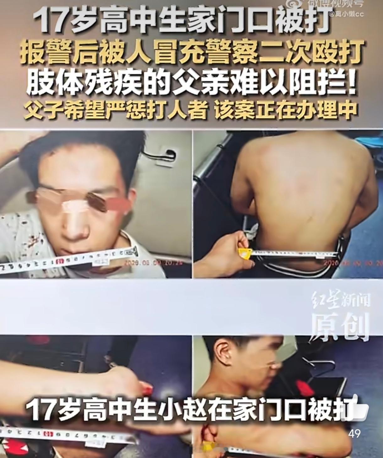 警方回应男生遭假警察二次毒打一个17岁孩子相信"警察来电"下楼配合，却落入被打后
