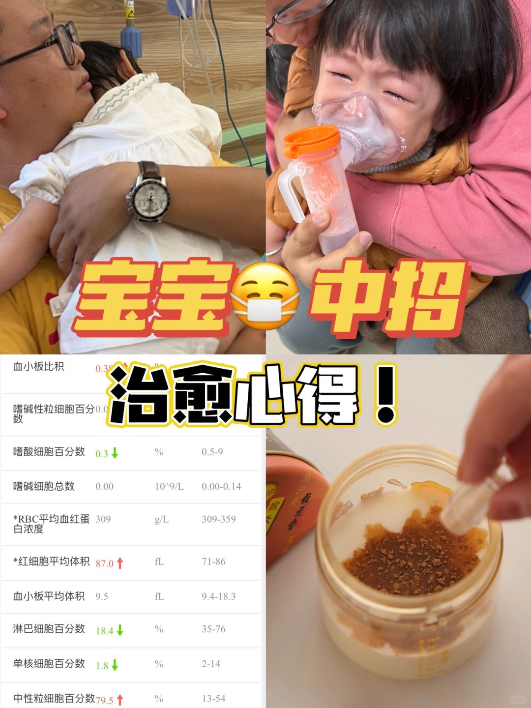 最近这波支原体和甲流真的是太可怕了，
橙子姐姐也不慎中招！
一开始还以为只是单纯...